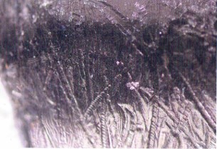 プロフェッショナルケア