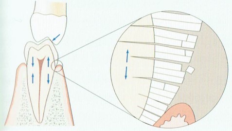 咬合力による歪み